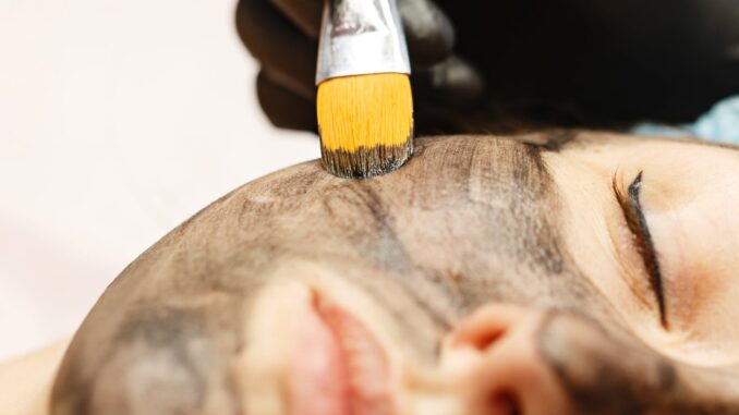 Forradalmi carbon peeling kezelés az Apollon Beauty kozmetikában